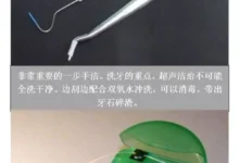 尾和牙攻略,经常洗牙对牙齿好吗-游戏人间