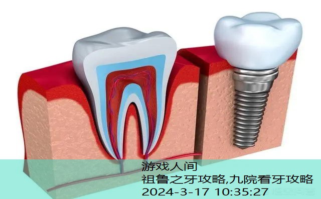 种牙种植牙